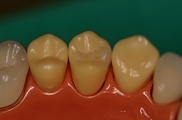 �|�[�Z�����C�����[